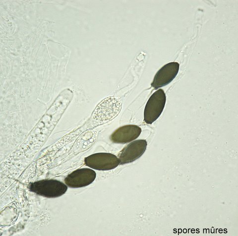 macrostoma