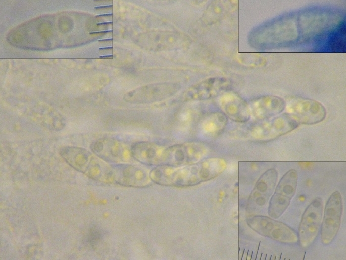 macrostoma
