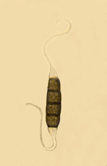 macrostoma