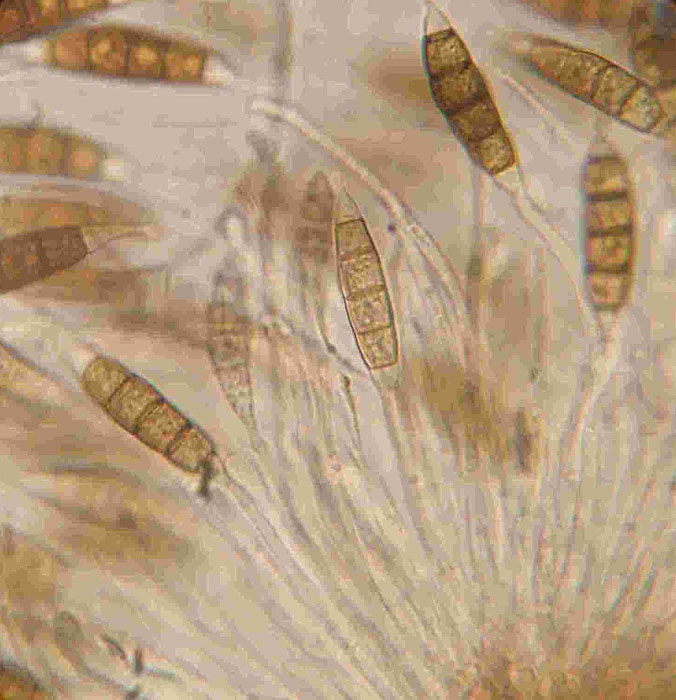 macrostoma