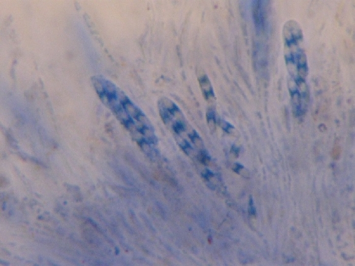 macrostoma