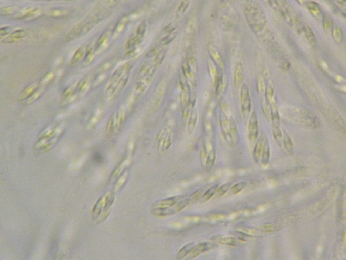 macrostoma