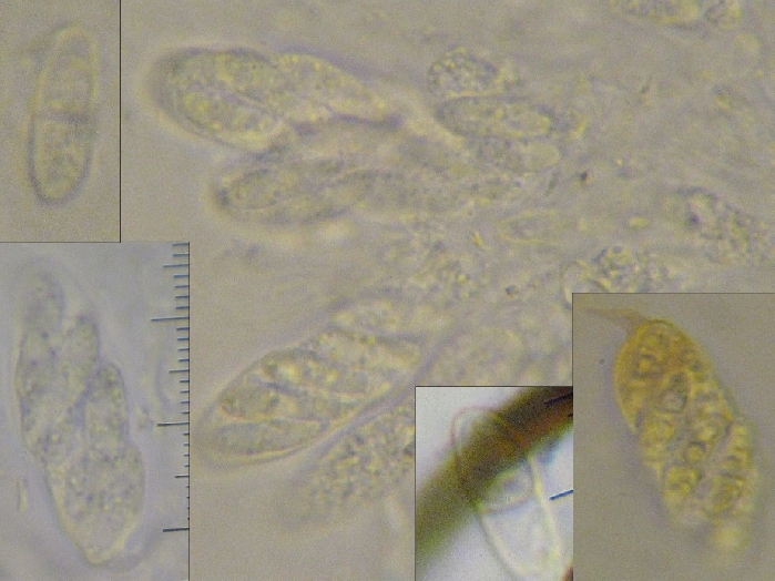 macrostoma