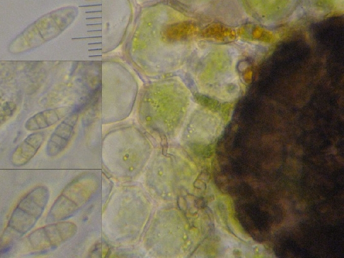 macrostoma