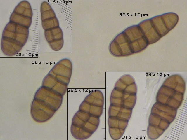 macrostoma