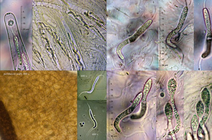 macrostoma