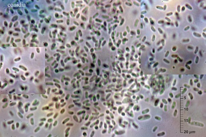 macrostoma
