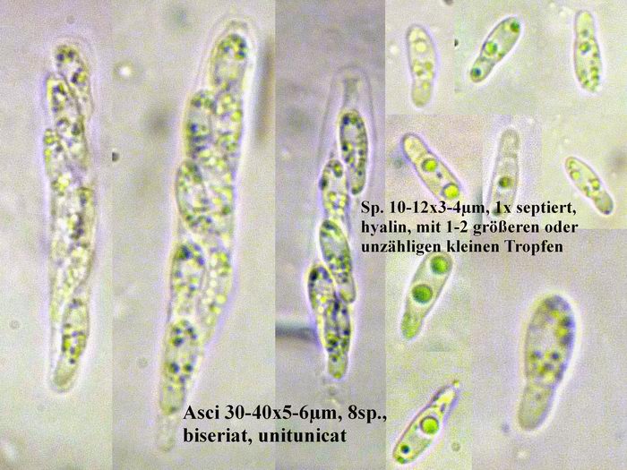 macrostoma