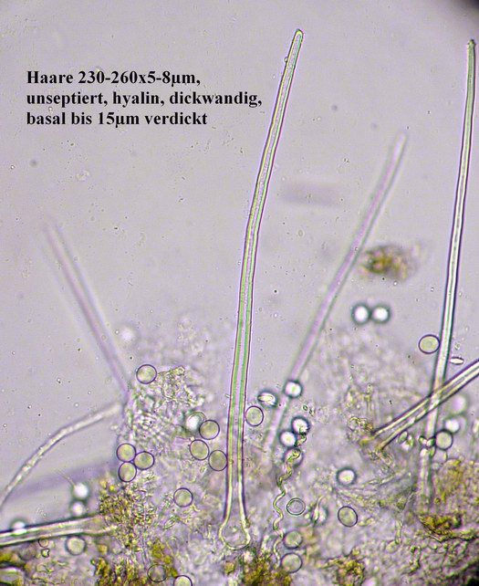 macrostoma