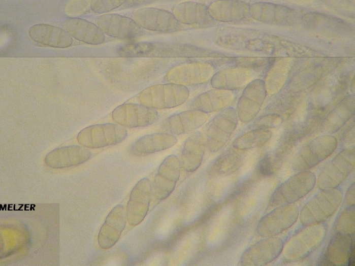 macrostoma
