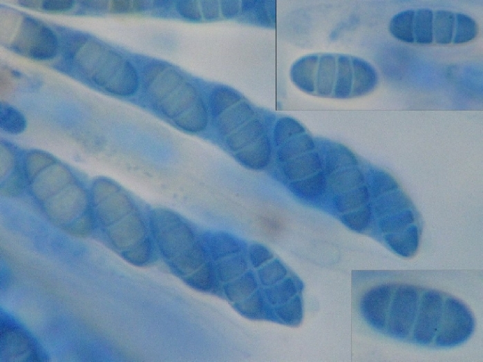 macrostoma