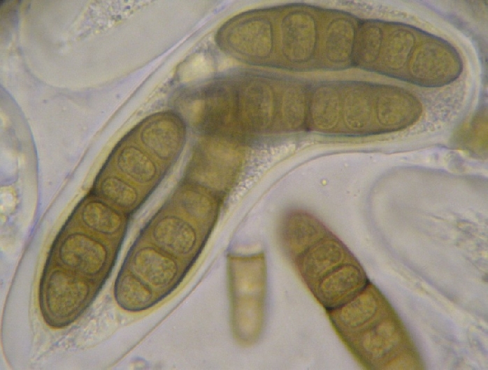 macrostoma