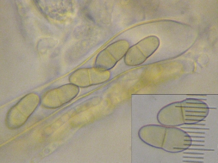 macrostoma