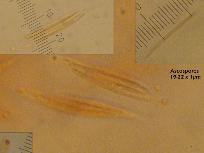 macrostoma