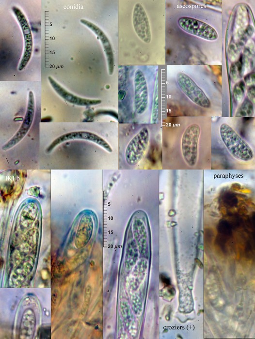 macrostoma