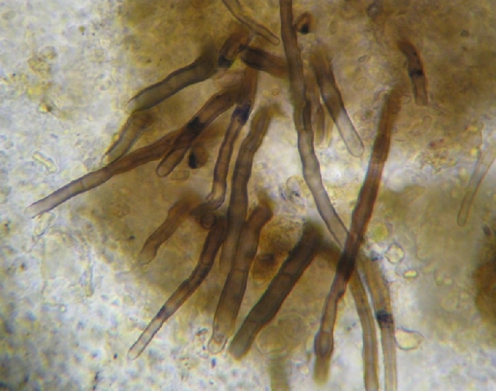 macrostoma
