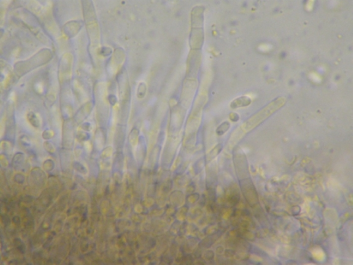 macrostoma