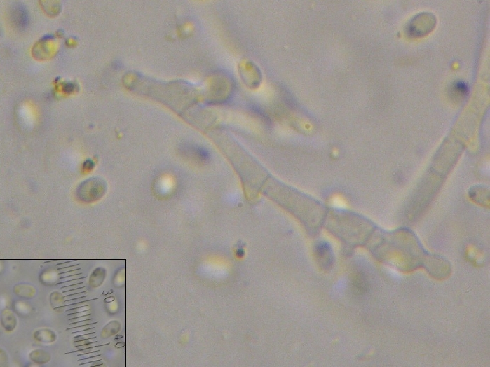 macrostoma