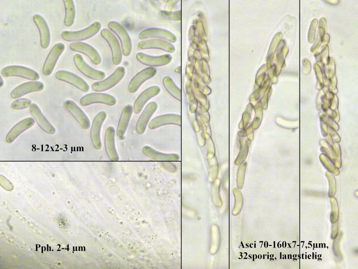 macrostoma