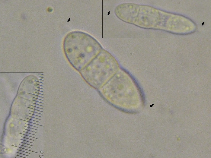 macrostoma