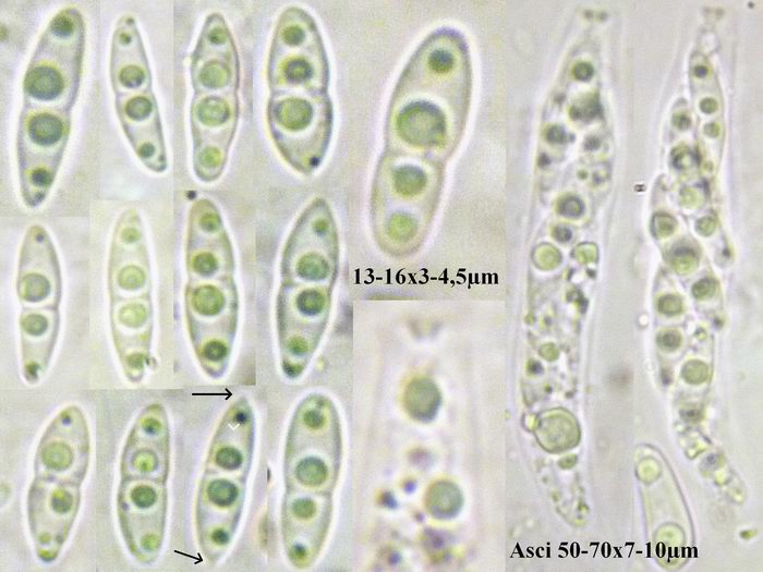 macrostoma