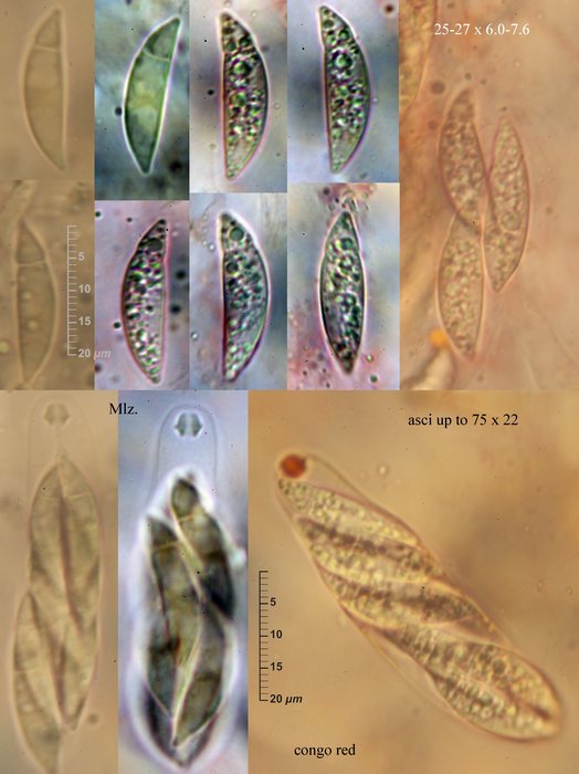 macrostoma