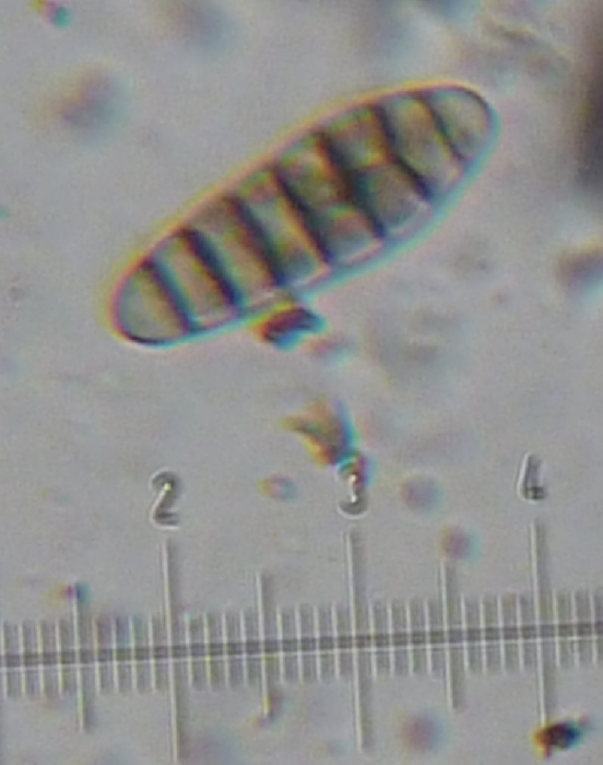 macrostoma