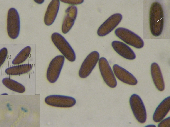macrostoma