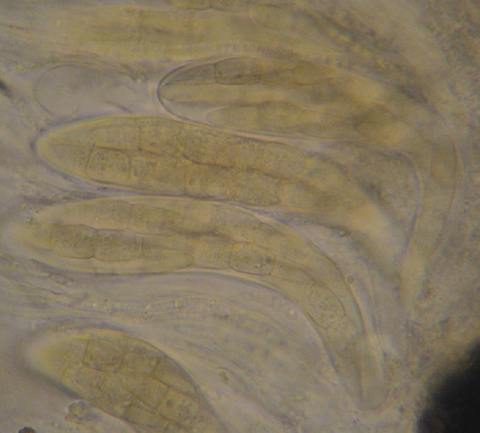 macrostoma