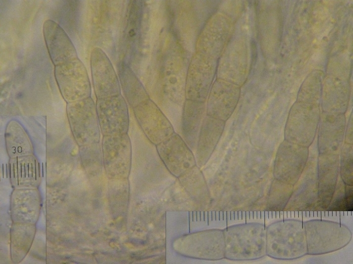 macrostoma
