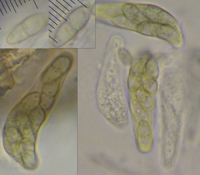 macrostoma