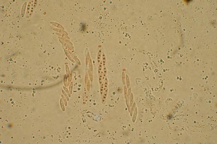 macrostoma