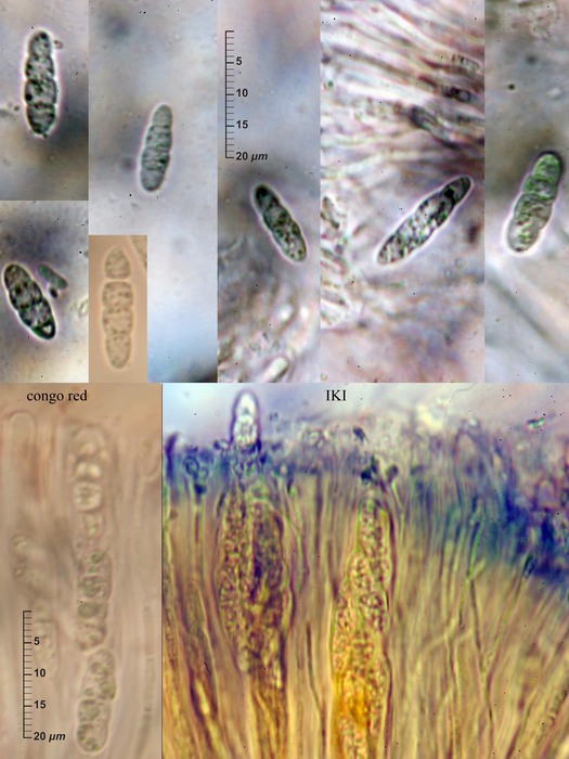 macrostoma