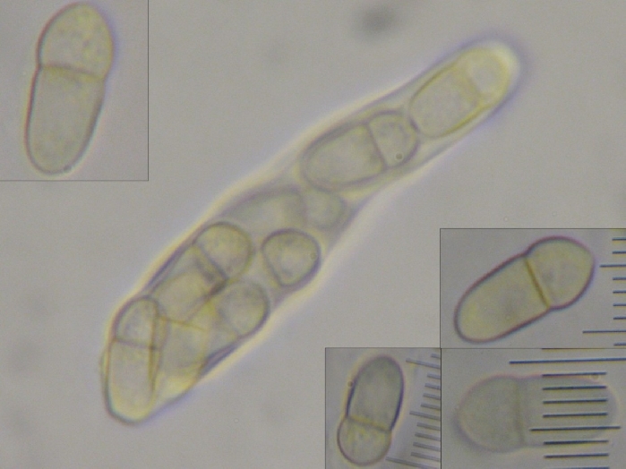 macrostoma