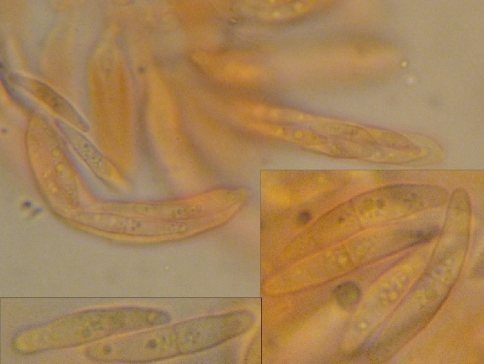 macrostoma