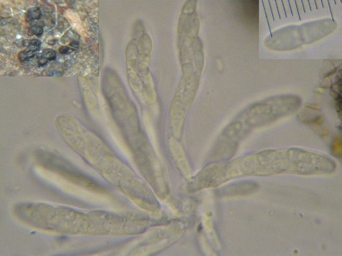 macrostoma