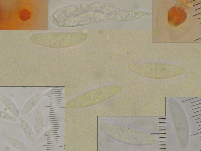 macrostoma