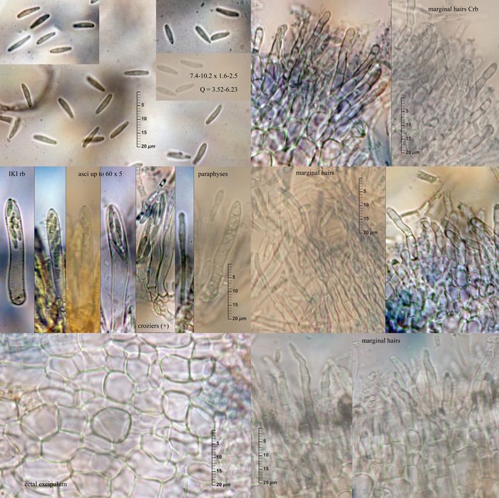 macrostoma