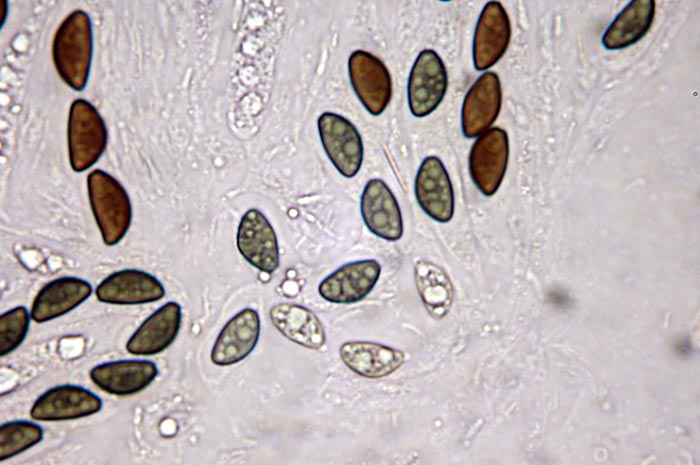macrostoma