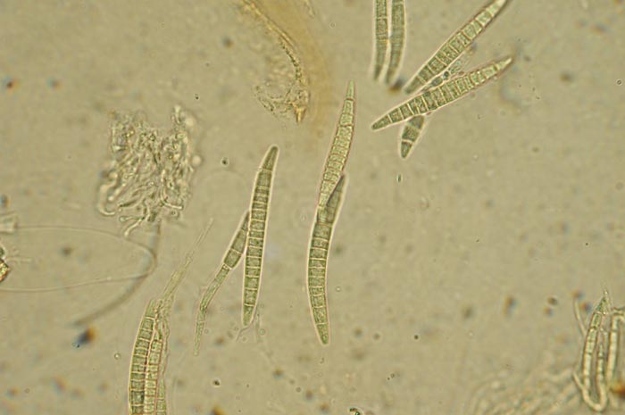 macrostoma