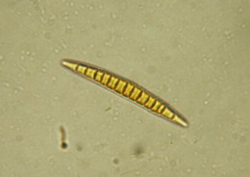 macrostoma
