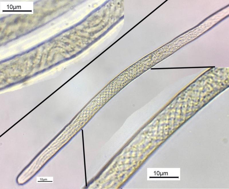 macrostoma