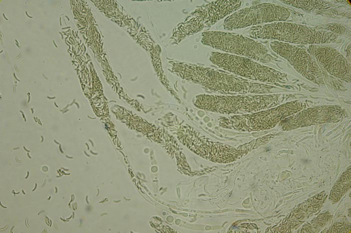 macrostoma