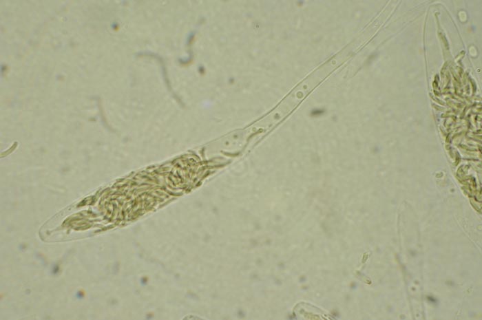 macrostoma