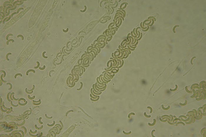 macrostoma