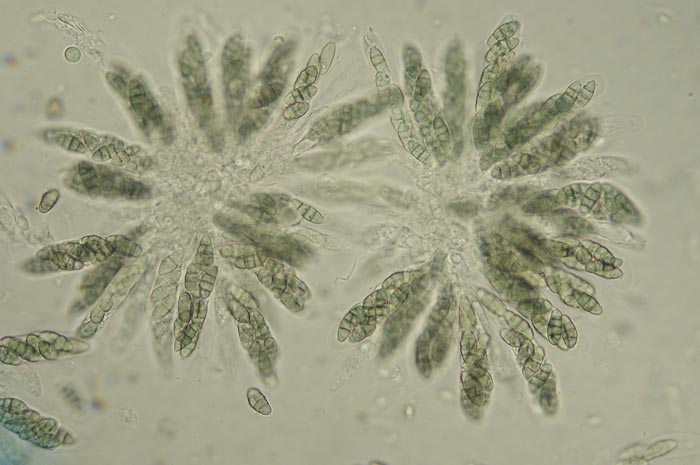 macrostoma