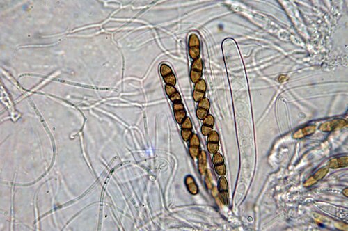 macrostoma