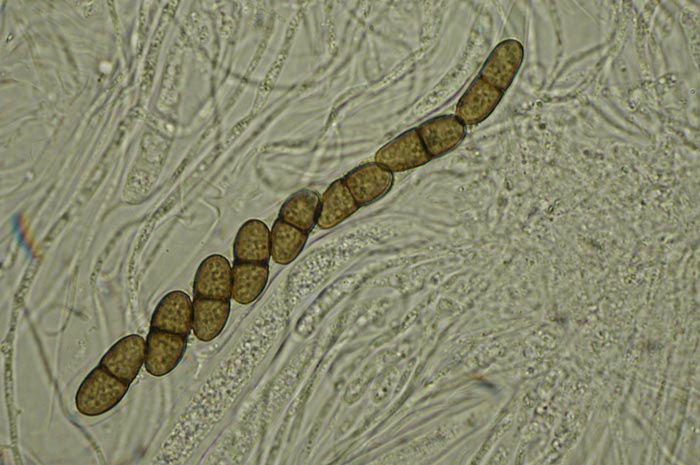 macrostoma