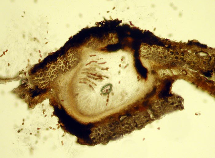 macrostoma