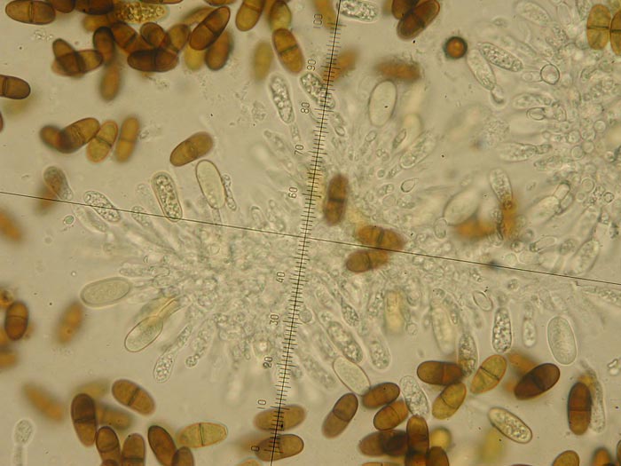 macrostoma